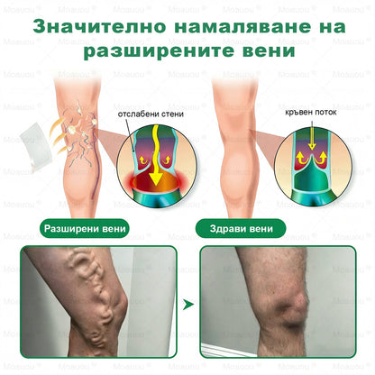 🇧🇬👨‍⚕️✅✅Moauou® Микроиглен пластир за таргетирано действие при разширени вени ⚡Незабавно облекчение, дълготраен ефект — специална промоция
