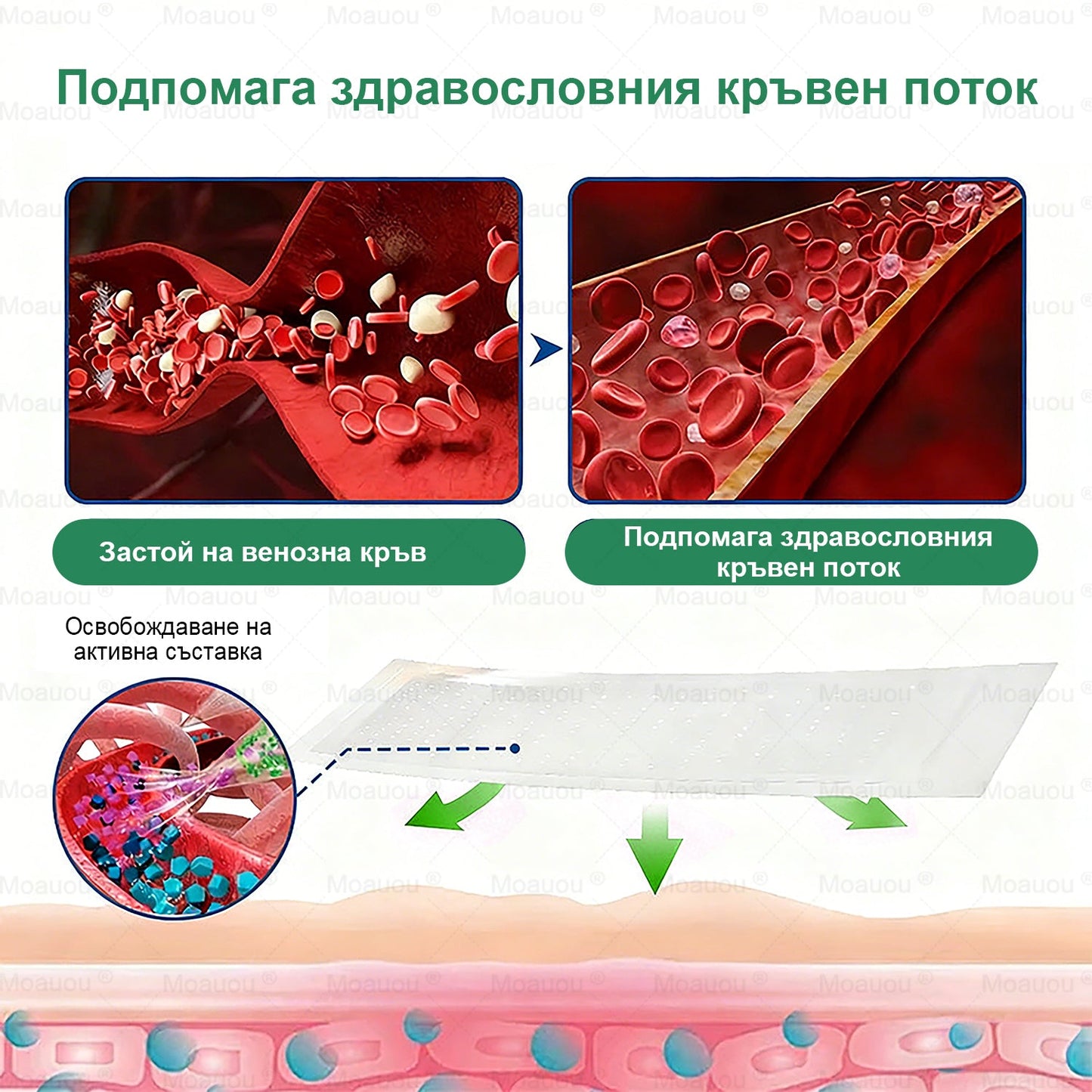 🇧🇬👨‍⚕️✅✅Moauou® Микроиглен пластир за таргетирано действие при разширени вени ⚡Незабавно облекчение, дълготраен ефект — специална промоция