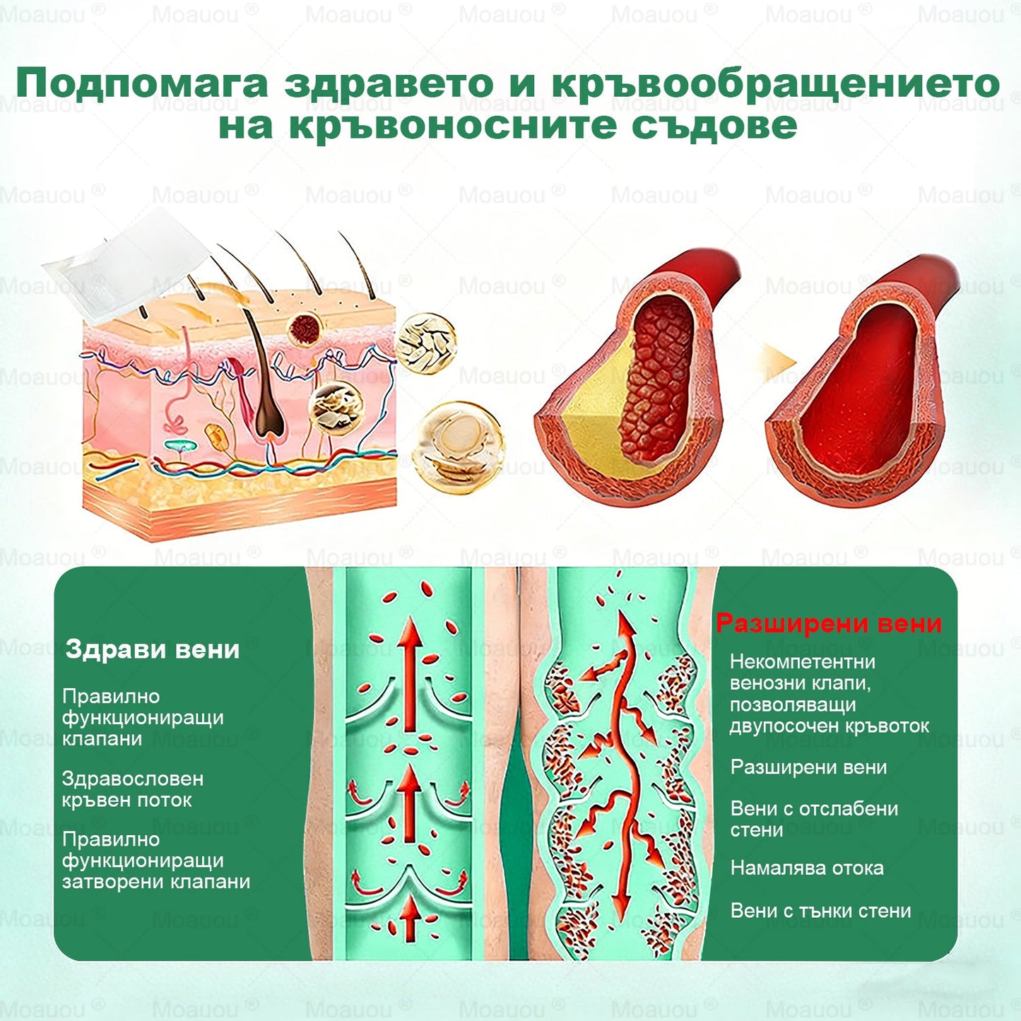 🇧🇬👨‍⚕️✅✅Moauou® Микроиглен пластир за таргетирано действие при разширени вени ⚡Незабавно облекчение, дълготраен ефект — специална промоция